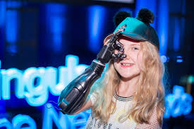 استخدام الطباعة ثلاثية الأبعاد في صناعة الأطراف الاصطناعية