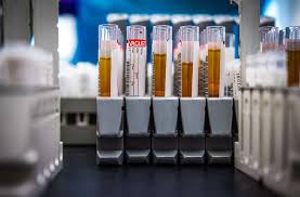 blood in urine